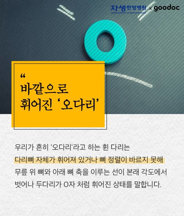 허리통증 당신의 다리 모양이 원인이다 | 출처 : 굿닥
