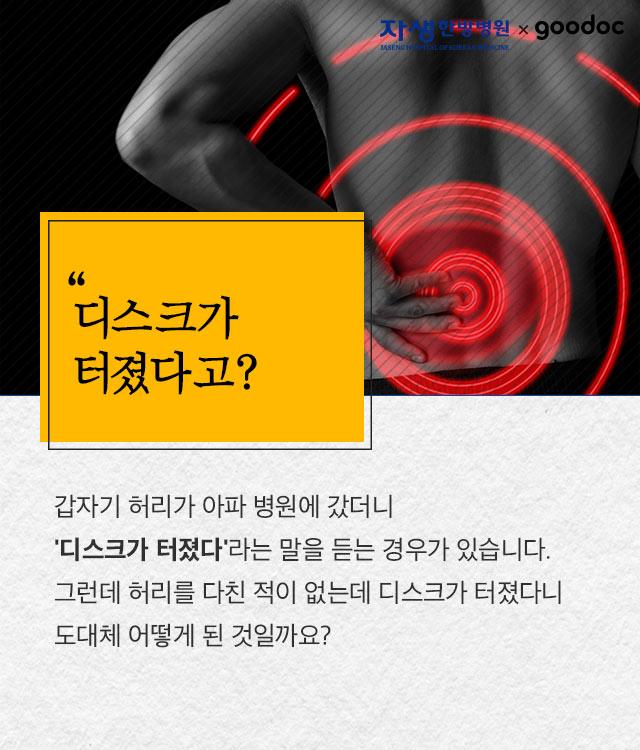 [허리] 허리디스크가 터졌어요..! | 출처 : 굿닥