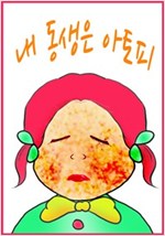 내 동생은 아토피 -