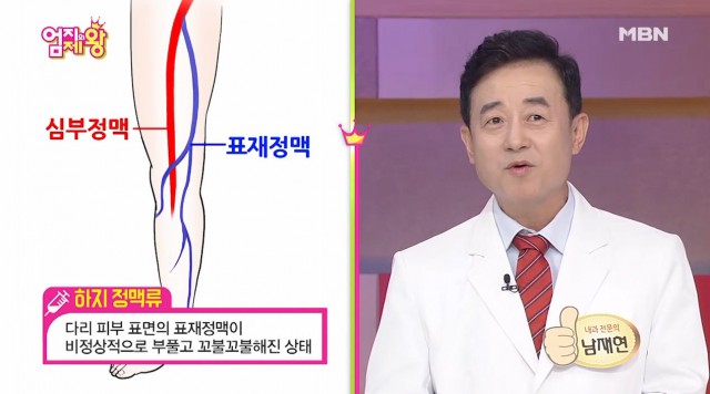 [다리] 다리가 저린데.. 나도 하지정맥일까? | 출처 : 굿닥